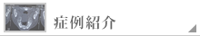 症例について