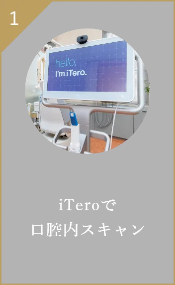 iTeroで口腔内スキャン