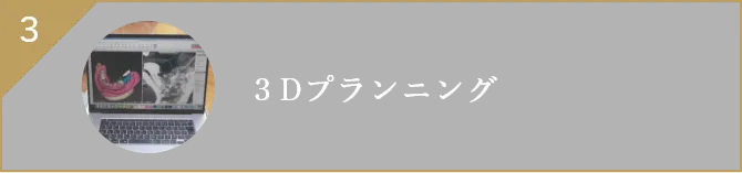 3Dプランニング