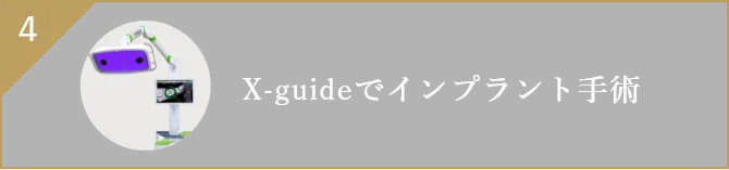 X-guideでインプラント手術