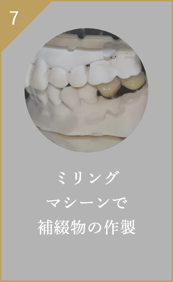 ミリングマシーンで補綴物の作製