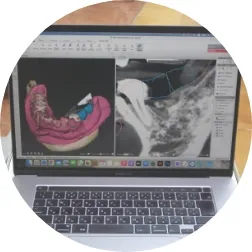 3Dプランニング