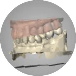 スキャンデータを技工所に送り